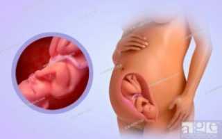 Ноет поясница на 34 неделе беременности