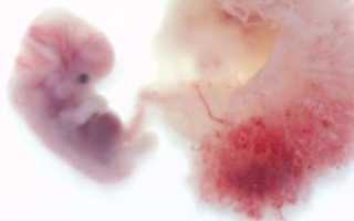 Кровь на пятой неделе беременности