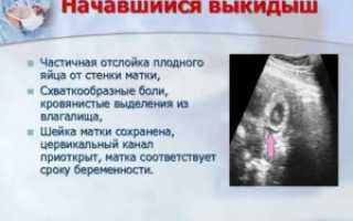 Желтые Выделения После Отслойки Плодного Яйца