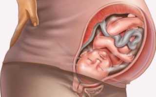 Тонус матки при беременности на 35 неделе беременности