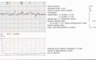 Норма Шевелений Плода На 38 Неделе Беременности
