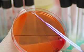 Бак посев мочи сколько дней готовится