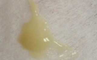 Выделения На Поздних Сроках Беременности Желтые