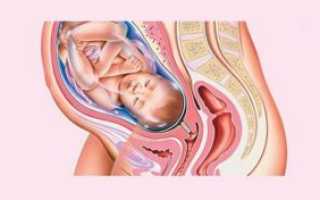 Тонус на 30 неделе беременности симптомы