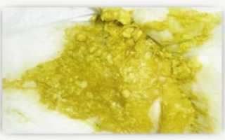 Почему годовалый ребенок часто какает