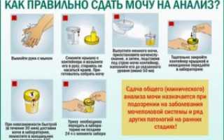 Как правильно сдавать анализ мочи при беременности с ватным тампоном