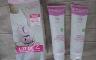 Крем от растяжек для беременных mustela отзывы