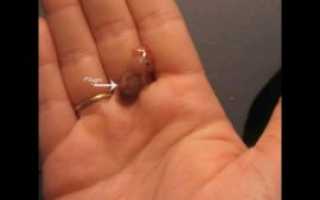 Как выглядит плодное яйцо на 5 неделе при выкидыше