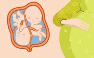 39 Неделя беременности двойня