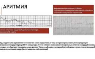 Начальные Нарушения Состояния Плода При Ктг Причины