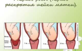 Раскрытие шейки на 3 пальца когда рожать