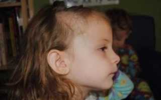 У ребенка медленно растет голова