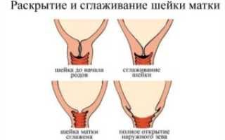 Если шейка матки готова к родам когда рожать