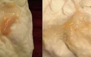 39 Неделя беременности кровянистые выделения