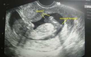 Можно ли на 15 неделе беременности узнать пол ребенка