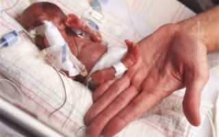 Роды на 25 неделе беременности форум