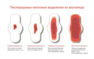 Через три недели после родов начались кровянистые выделения