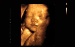 3D узи на 25 неделе беременности фото