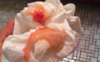 После осмотра гинеколога отошла слизистая пробка