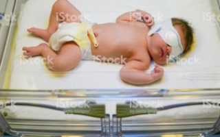 Если при рождении ребенок наглотался околоплодных вод последствия