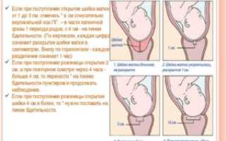 Если матка открылась на 1 палец когда рожать
