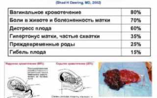 Отслойка плаценты 39 неделе беременности