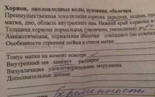 Преимущественная локализация хориона дно матки что это значит