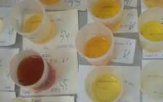 Почему моча при беременности сильно пахнет