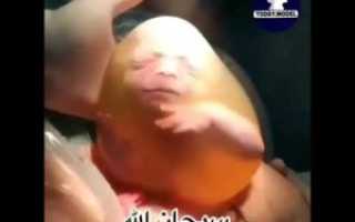 Ребенок в околоплодном пузыре фото