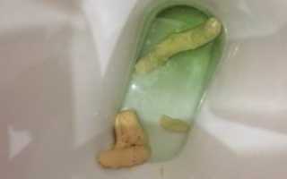 Во время беременности светлый кал