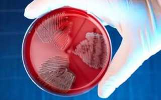 Лечение стрептококковой инфекции в урологии