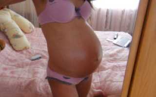 Каменеет живот на 31 неделе беременности но не болит