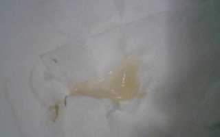 Слизь на 21 неделе беременности