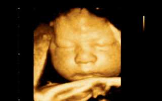 На каком сроке делать лучше 4d узи