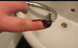 Месячные после задержки со сгустками