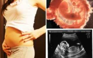 13 Неделя от зачатия