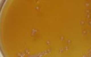 Дрожжи в моче при беременности