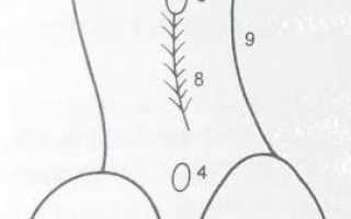 Ситуационные задачи по теме «Травма органов мочевой и мужской половой систем»