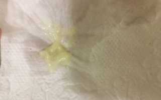 Могут ли с пессарием подтекать воды