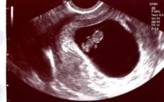 Тошнит на 9 недели беременности