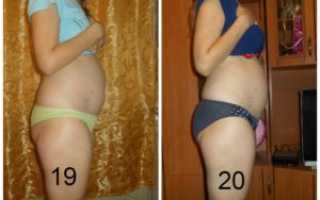 Покалывает низ живота 9 неделе беременности