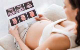 Первые шевеления плода при первой беременности у полных женщин