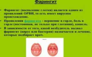 Вирусный Фарингит Симптомы И Лечение У Детей