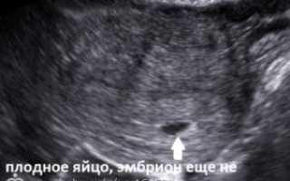 Плодное яйцо больше эмбриона на две недели