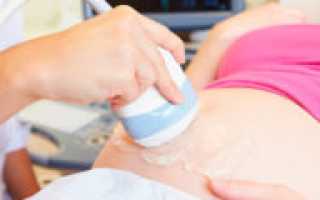 Можно ли делать узи 2 дня подряд при беременности