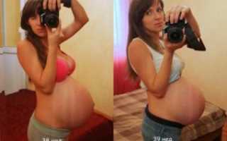 За сколько дней опускается живот перед родами у повторнородящих