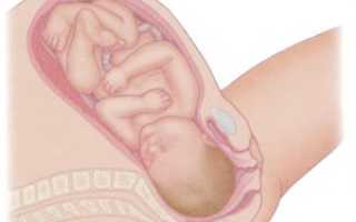 39 Неделя беременности набухла грудь когда рожать