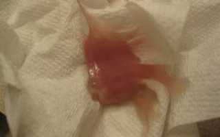 Пробка на 40 неделе беременности отходит