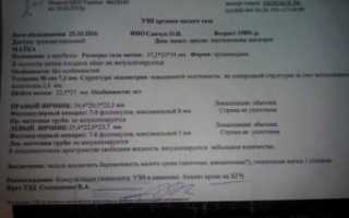 В позадиматочном пространстве свободная жидкость при беременности