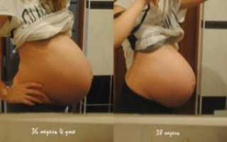 На какой неделе живот начинает опускаться при беременности